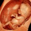 aborted-babies-used-as-fuel-source-to-heat-hospitals-abortion-is-murder-molech