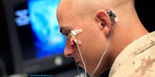 Obama’s Military Begins Implanting Cybernetic Microchips In Soldier’s Brains To Treat PTSD Obama’s Military Begins Implanting Cybernetic Microchips In Soldier’s Brains To Treat PTSD