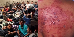 Obama Is Allowing Flood Of Illegal Aliens To Bring Plague Upon American Citizens Obama Is Allowing Flood Of Illegal Aliens To Bring Plague Upon American Citizens