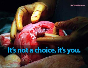 abortion-is-not-a-choice