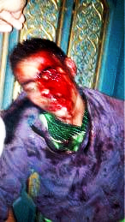 muslim-brotherhood-torture-chambers-discovered-obama-supports-1 muslim-brotherhood-torture-chambers-discovered-obama-supports-1