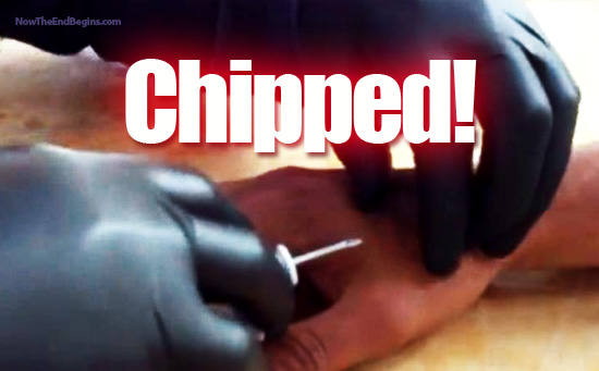 The World Begins To Embrace The Implantable RFID Microchip