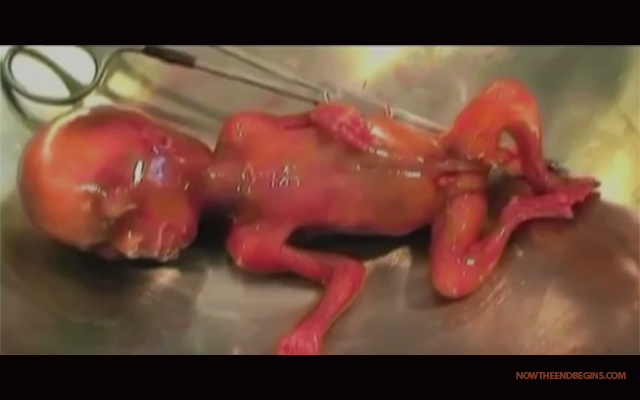 planned-parenthood-cuts-though-live-babies-face-to-extract-intact-brain-abortion-01