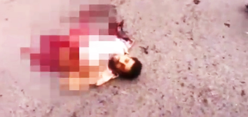 isis-suicide-bomber-blows-himself-in-half-found-alive-talking-allahu-ackbar