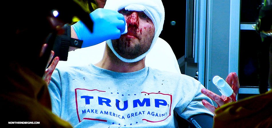 violence-bloodshed-from-hillary-clinton-supporters-attacking-donald-trump-project-veritas