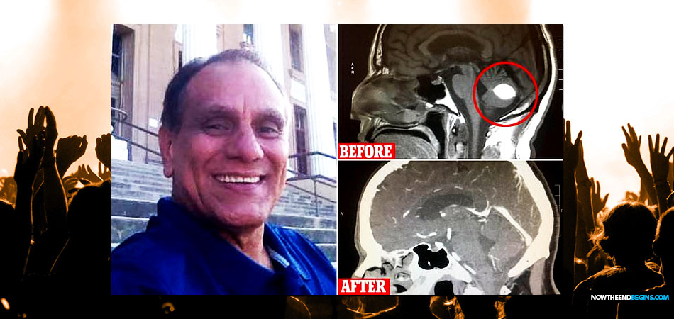 doctors-verify-california-man-brain-tumor-vanishes-after-trusting-god-prayer-church-miracle-healing