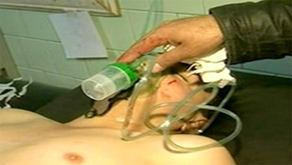 first-chemical-weapon-attack-in-syria-march-19-2013